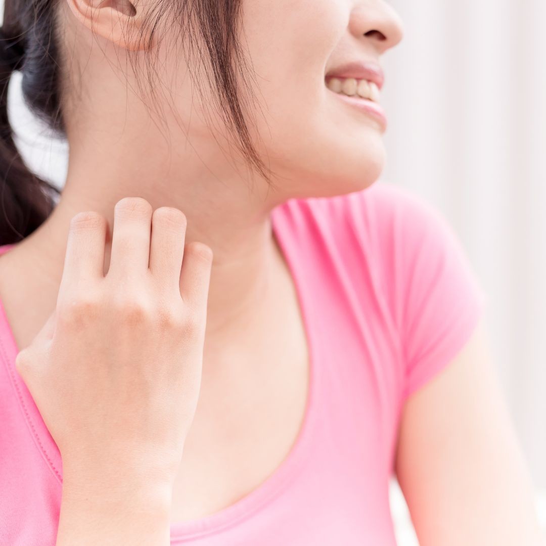 Eczema on wonman neck